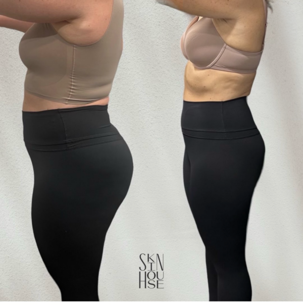 Medical weight loss before and after results Birmingham MI