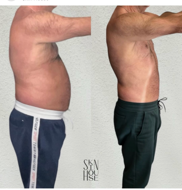 Medical weight loss before and after results Birmingham MI