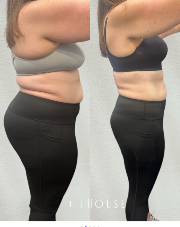 Medical weight loss before and after results Birmingham MI